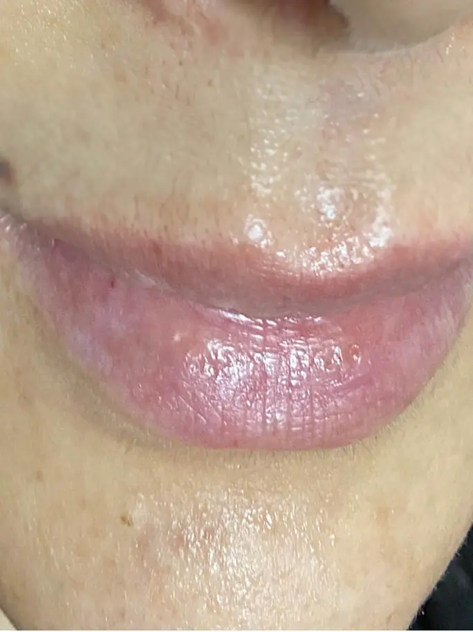 قبل از حجم سازی